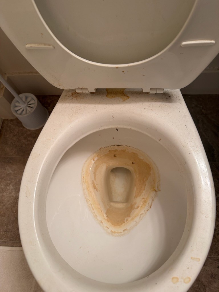 Toilet bowl with hard water rust ring before cleaning